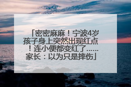 密密麻麻！宁波4岁孩子身上突然出现红点！连小便都变红了……家长：以为只是摔伤